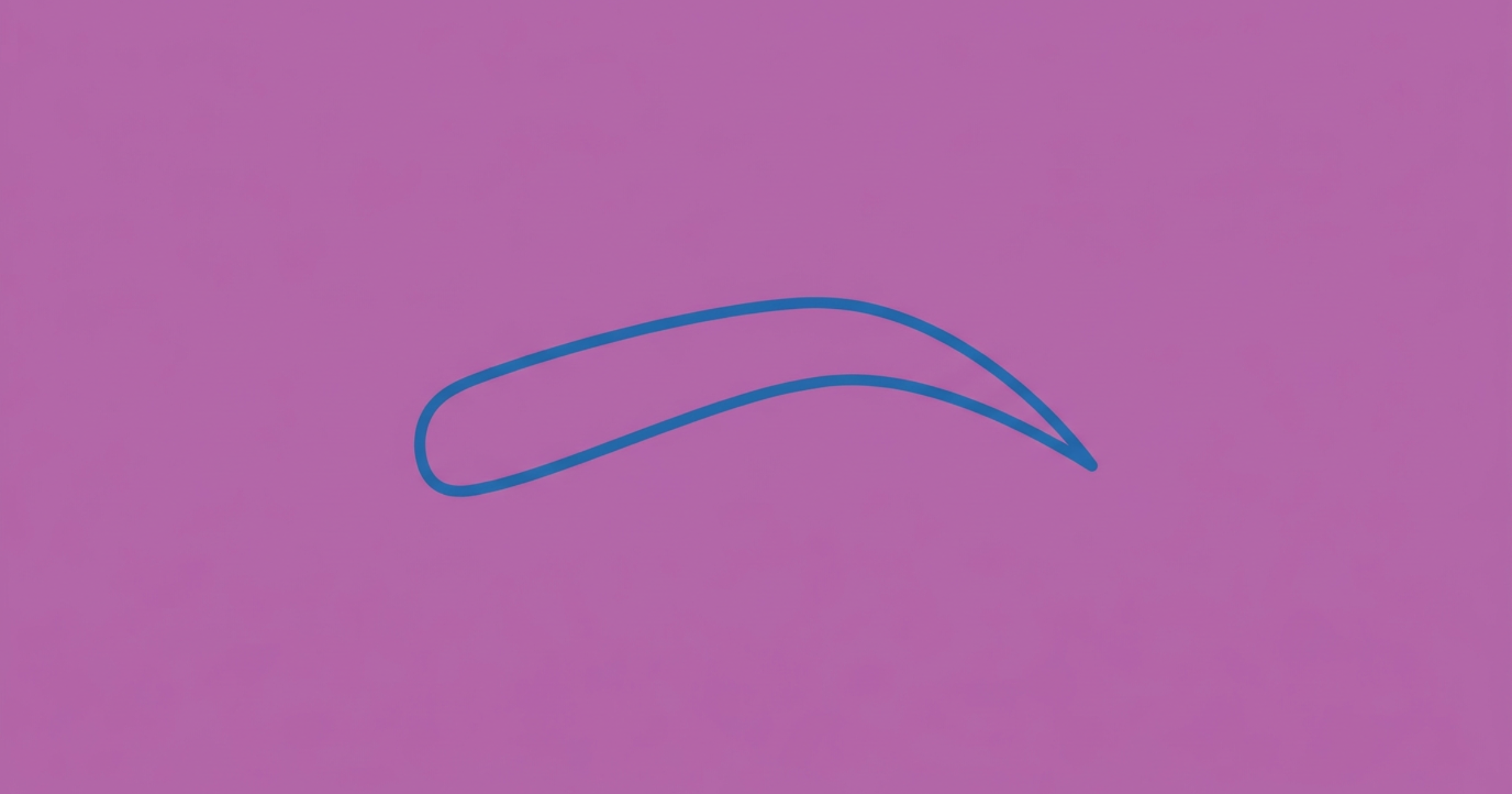 Brow Ptosis — clinical reference illustration